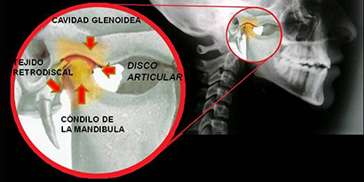 Anatomía función ATM Doctora Lavara